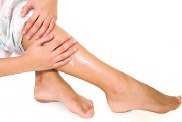 The treatment of varicose veins