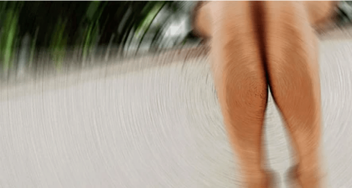 How to treat the Varicosis Veels at home