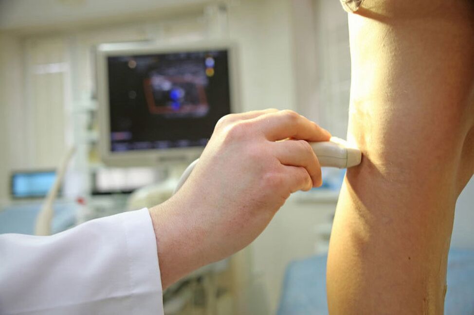 Ultrasound of the veins of lower extremities