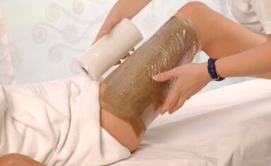 Children for varicose veins are possible to wrap