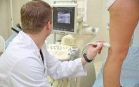 Methods of treatment of varicose veins in legs in women